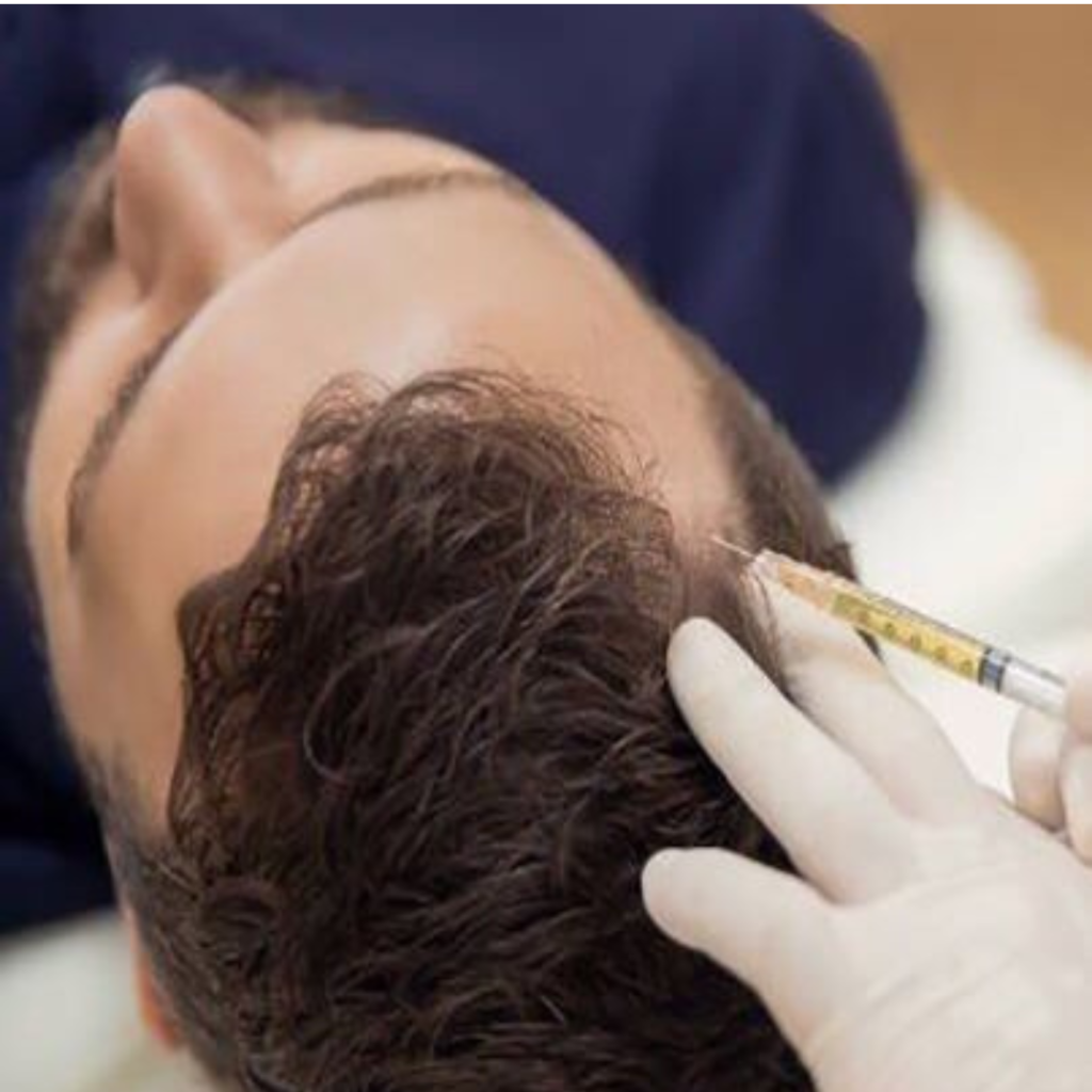 PRP Hair Treatment in Jabalpur